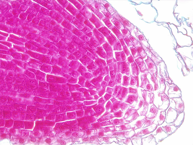 Dicot Lateral Root Slides - Dicot Lateral Root 01 400X